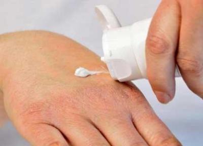 درمان های خانگی رفع ترک دست ها در زمستان