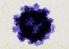 یک ویروس (نوروویروس) معده مشکوک به ایجاد بیماری التهابی روده (کرون) است